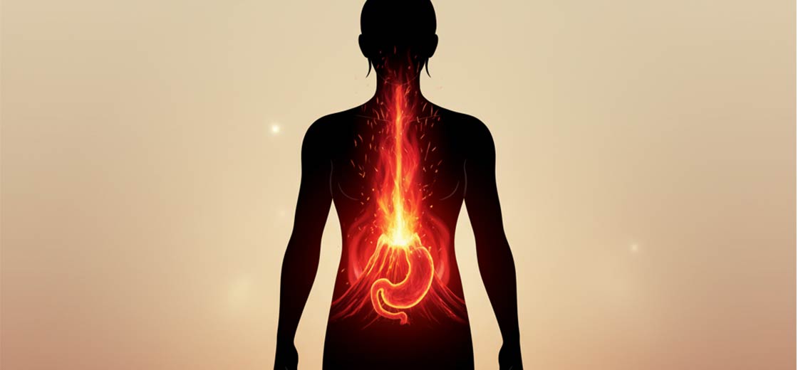 silhouette di una persona con evidenziata l’area dello stomaco e dell’esofago, che si illumina come un piccolo vulcano in eruzione. Effetto visivo: il calore e il bruciore sono rappresentati con luci rosso/arancio che salgono verso l’alto, creando un impatto immediato. Atmosfera: chiara, moderna, semi-illustrata.